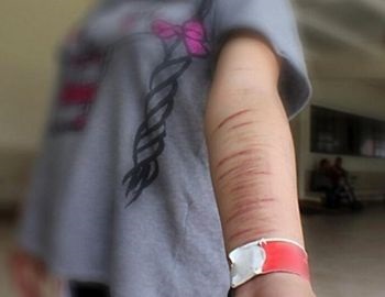 el que las ni�os y j�venes se autolesionen, nos estan dando un mensaje