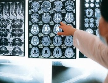 estudios para el diagn�stico del s�ndrome